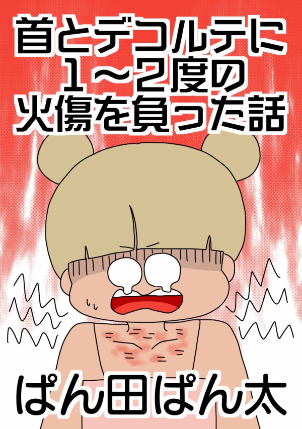 人生で一番火傷した話-5- : ぱんをたずねて2000里ちょい Powered by