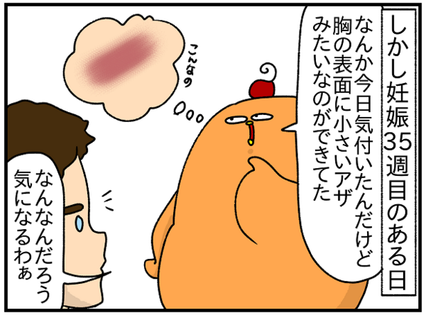 344 妊娠35週 ついに出た妊娠線 ぱんをたずねて00里ちょい Powered By ライブドアブログ