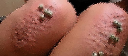 恐ろしい体罰としてネット上に出回った1枚の写真 蓮コラの刑 ザイーガ