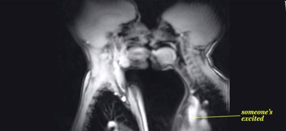 人体まるわかり キスから合体 出産まで体の中身をmrtで撮影した映像 ザイーガ