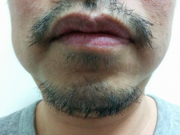 ヒゲ抜くのはやめとけおじさん ひげ抜くのはやめとけ ワイ ほーん ﾋｹﾞﾇｷｰ ぶる速 Vip