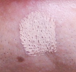 顔のニキビや染みやクレーターを目立たなくする コンシーラー の効果の程 鳥取の社長日記