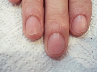 甘皮のケアの必要性 深センの日本人ネイルサロン Rico Nail のブログ