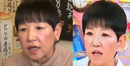 和田アキ子 眼瞼下垂手術結果に「落差大きく」「ものすごい変な