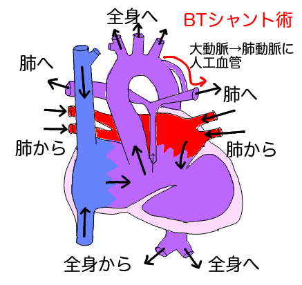 新しく作った心臓の図解 まるがお親子