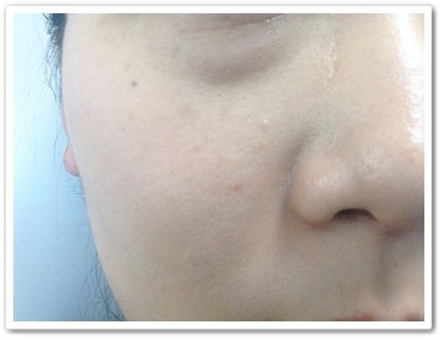 ロスミンローヤル10ヶ月の記録 最初は怪しいと思ってましたが ロスミンローヤルでシミ消し 冷え性解消 口コミ今日も発信中