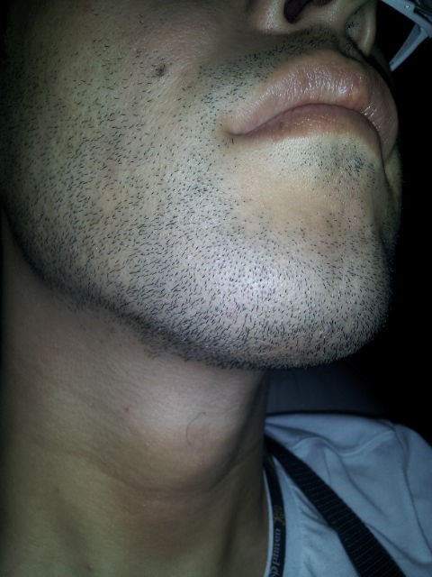 髭 ヒゲを薄くする方法を教えろ 脱毛 幸癒ニュー速vip 2ch まとめ