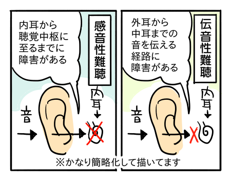 骨 伝導 イヤホン 聴覚 障害 ショップ 者