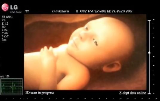 Youtube海外映像 エコー検査中に胎児が手を振ってきたら 自由気ままに