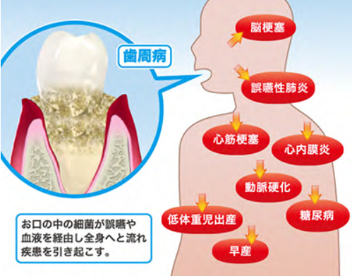 健康のための日課 朝起きたら即歯磨きする 元気シニアの呑気日記