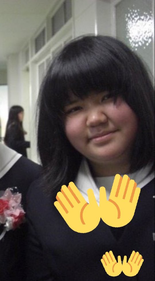 朗報 オタクデブ女さん 痩せてとんでもない美人になるｗｗｗ 劇的ビフォーアフター ガールズ速報