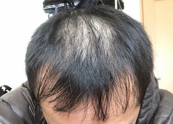 画像 湯シャンを3年続けた結果 スパロボニュース