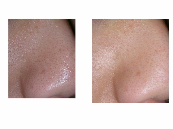 毛穴 肌を500円でキレイにする方法聞いたのだが ささやかな楽しみ