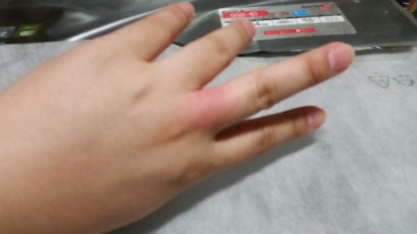 かゆいよ daydream