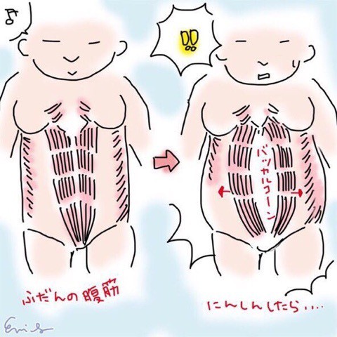 妊婦は腹筋がバッカルコーン 産後の腰痛はこうやって起こっていた チェック方法も載ってるよ フランダースの三姉妹 さとえみ日記 Powered By ライブドアブログ
