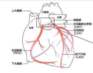 12誘導心電図を読んでみよう 67歳男性 胸やけ症状 心電図の部屋