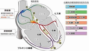 ペースメーカーとは 心電図の部屋