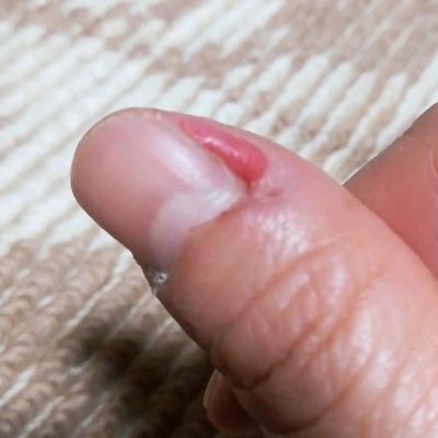 正常と異常の境界線 ひみつのパナ園