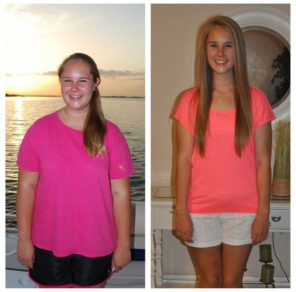 ダイエットに成功し 激デブから美女に変身した女性達の画像集 画像２１枚 世界の憂鬱 海外 韓国の反応