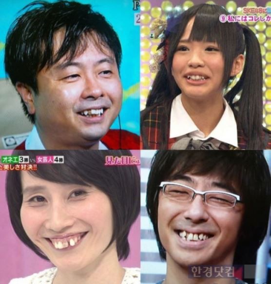 韓国人 日本人の歯並びが悪いのは何故なのか 遺伝子 八重歯がかわいいという文化的影響 韓国の反応 世界の憂鬱 海外 韓国の反応