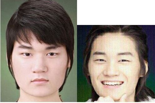 韓国人 イケメンに成る方法 整形手術で人生大逆転 不細工が超イケメンに成ったビフォア アフター画像をご覧ください 世界の憂鬱 海外 韓国の反応
