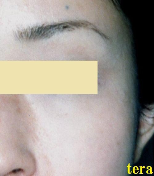 しみ テラ医者の独り言 普通 時々テラめし