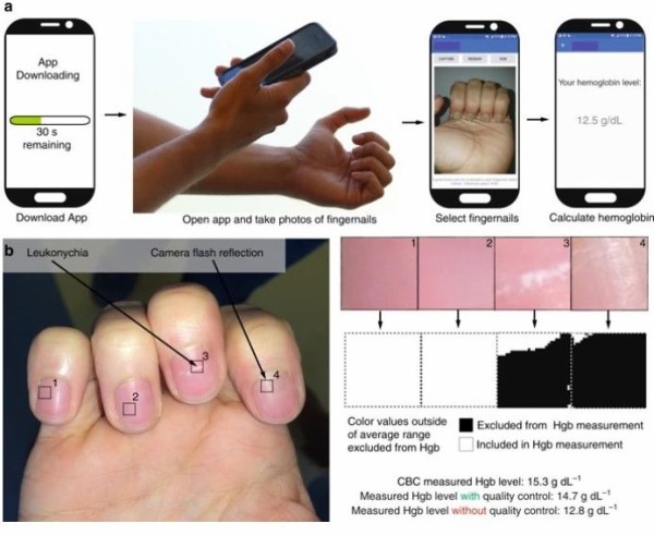 スマホを使った採血しない貧血検査 ひかたま 光の魂たち