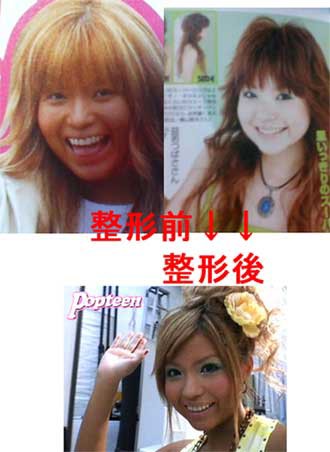 美容整形でなりたい顔ランキング女性編 高須クリニック集計 整形画像あり テレビドラマ 視聴率 その他 気になる芸能データ