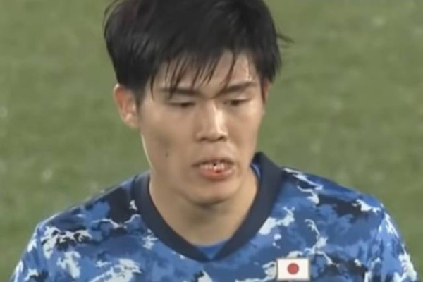 冨安健洋顔面流血の ラフプレー を韓国メディア批判 マナーすらなかった 親善試合でこれはなんだ サッカータイム 冨安健洋顔面流血の ラフプレー を韓国メディア批判 マナーすらなかった 親善試合でこれはなんだ サッカータイム