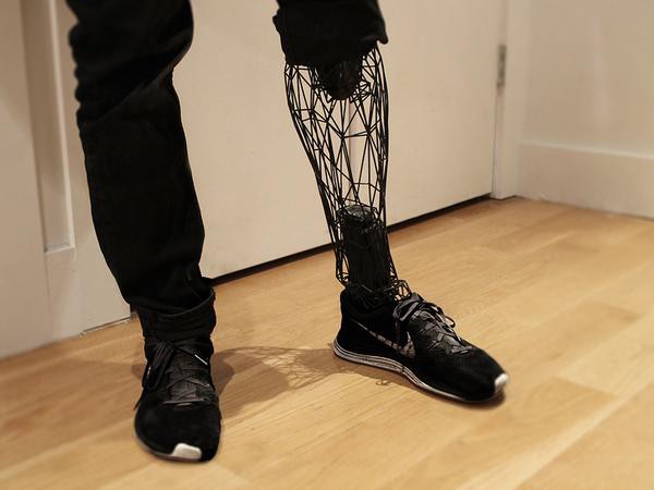 画像あり 3dプリンタで義足をオシャレにするプロジェクトが 手に入れるのに プリント料金だけで済むことになるかもしれません そくどく