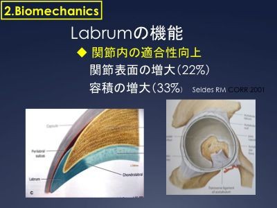 股関節唇損傷の特徴 当院のデーターベース スポーツ整形外科医s Uのブログ Sports Physician S U Blog