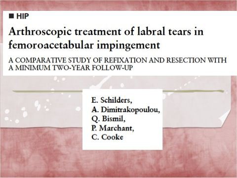 股関節インピンジメントに対する治療エビデンス 股関節唇縫合は 切除より優れた成績 スポーツ整形外科医s Uのブログ Sports Physician S U Blog