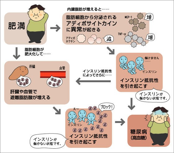 糖尿病のリハビリテーション 糖尿病で血液はトロトロに インスリン抵抗性の原因は運動不足 脳卒中にならないためのリハビリテーション