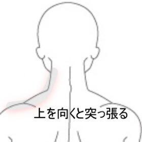 首の痛み 室蘭登別すのさき鍼灸整骨院 症例報告 すのさき鍼灸整骨院 副院長のブログ