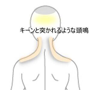 頭鳴 室蘭登別すのさき鍼灸整骨院 症例報告 すのさき鍼灸整骨院 副院長のブログ