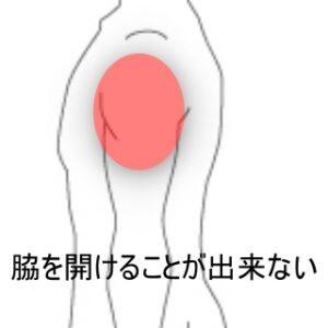 打撲した肩 室蘭登別すのさき鍼灸整骨院 症例報告 すのさき鍼灸整骨院 副院長のブログ