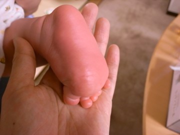 足の裏の出だし すみきちブログ