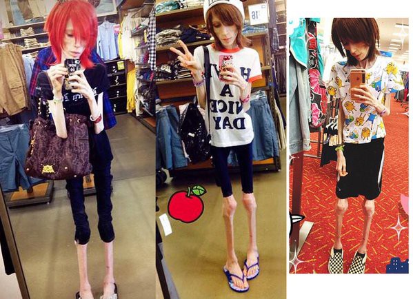 画像あり ガリガリ過ぎる女性が話題 どうやって立ってるの コラでは との声 気になるニュースまとめっち