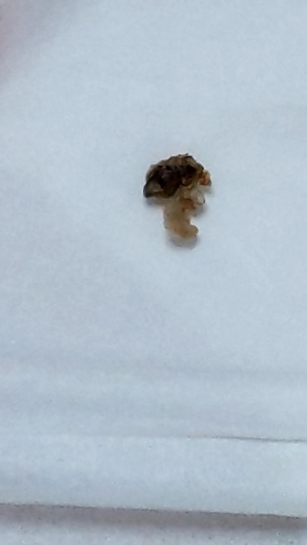 閲覧注意 年以上溜めたへそのゴマがついに取れた 画像あり 流速vip