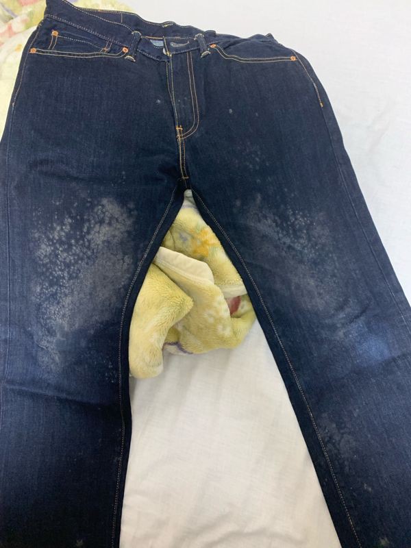 ジーパンにカビが生えた 助けてくれ 画像あり 流速vip