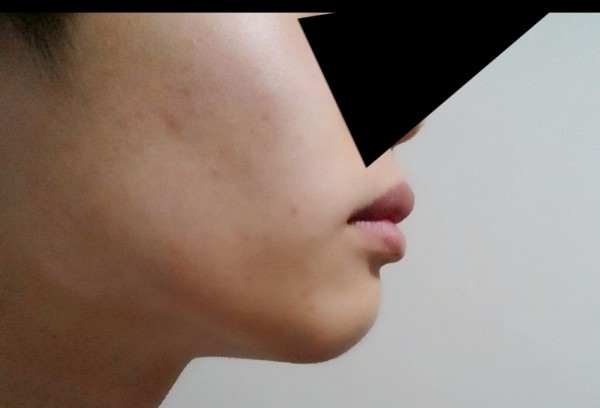 俺の口元が不細工すぎて横顔が終わってるんだが 画像あり 流速vip