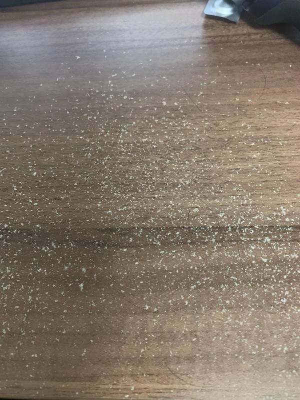 閲覧注意 俺の頭のフケやべぇｗｗｗ 画像あり 流速vip