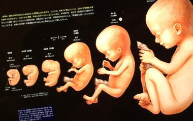胎児の成長過程を一望する 受精卵から人へ Newton Kindle版 発想法 情報処理と問題解決