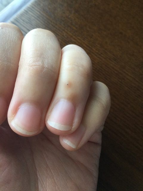 モノが多いとケガをしやすい 未だに取れないサボテンのトゲを見て思う のんびり楽しく貯金 Powered By ライブドアブログ