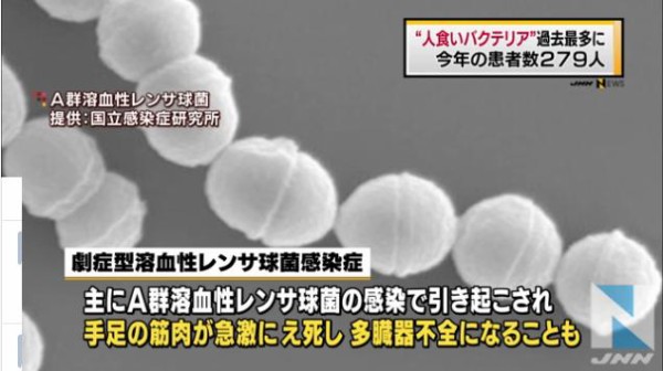 人食いバクテリア 今年の患者数２７９人 過去最多に 原因は 感染経路 トレンド通信