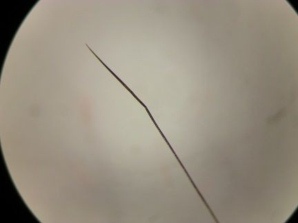 ネズミの体毛 虫捕りたちのつぶやき