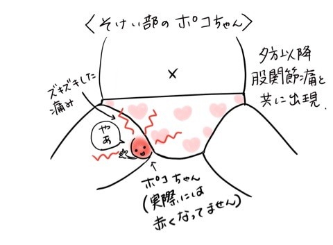 妊娠中のマイナートラブルを振り返る お股に謎のぽっこりの件 Tomekkoの宝箱 3兄弟と好きなもの Powered By ライブドアブログ 妊娠中のマイナートラブルを振り返る お股に謎のぽっこりの件 Tomekkoの宝箱 3兄弟と好きなもの Powered By ライブドアブログ