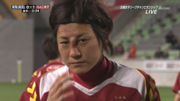 なでしこジャパン Inac神戸の近賀ゆかり 韓国チームとのゲームで蹴りを入れられ顔にけが とうとうバカとして生きることに決めました
