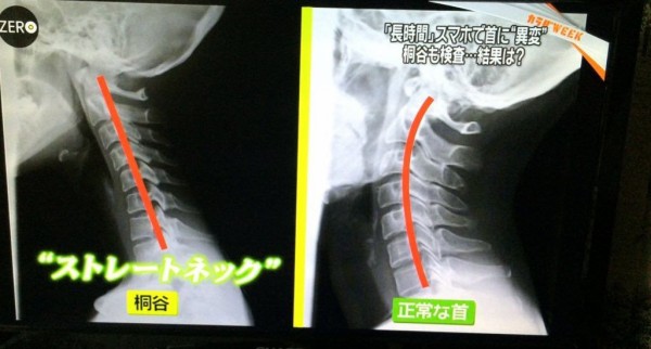 桐谷美玲にマッサージwwww フラッシュ速報