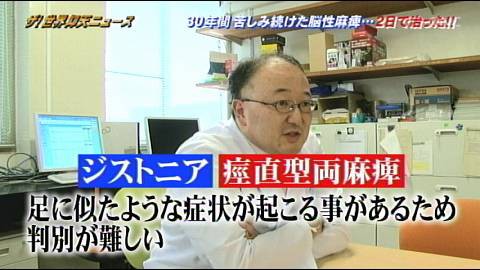 痙直型両麻痺とドーパ反応性ジストニア テレビっ子ひなのブログ